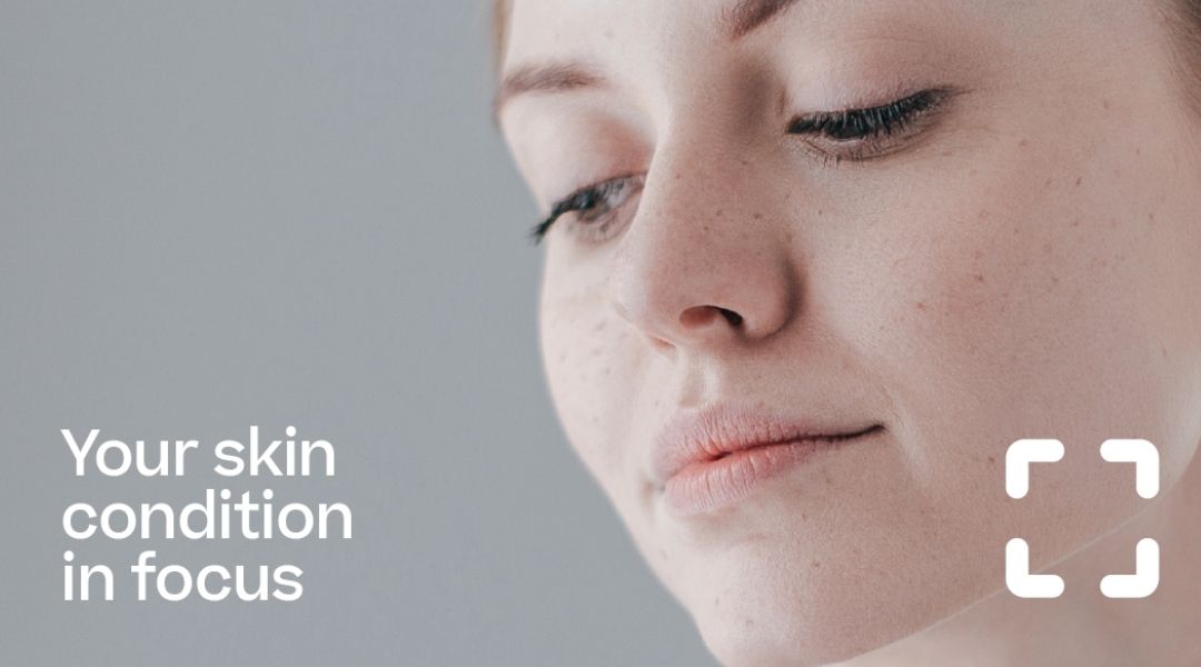 Τι σημαίνει υγιές δέρμα;